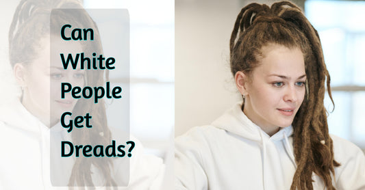 can white people get dreads